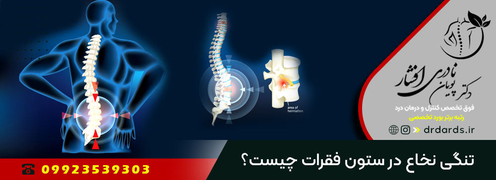 chiropractic treatment of spinal stenosis, how is back pain treated, laser treatment of spinal stenosis, non surgical treatment of spinal stenosis, pain of spinal stenosis, physical therapy treatment of spinal stenosis, spinal stenosis, spinal stenosis and walking problems, spinal stenosis exercises, spinal stenosis exercises to avoid, spinal stenosis icd 10, spinal stenosis mri, spinal stenosis nhs, spinal stenosis of lumbar region, spinal stenosis physical therapy exercises pdf, spinal stenosis treatment, treatment for spinal stenosis and sciatica, treatment of back pain, treatment of back pain after c section, treatment of back pain after delivery, treatment of back pain at home, treatment of back pain during pregnancy, treatment of back pain in early pregnancy, treatment of back pain in female, treatment of back pain in male, treatment of back pain in pregnancy, treatment of back pain iranian, treatment of back pain iranian journal, treatment of back pain isfahan medical college, treatment of back pain isfahan province, treatment of back pain isfahan university, treatment of back pain isfahan university of technology, treatment of back pain tehran iran, treatment of back pain tehran university, treatment of spinal stenosis in the elderly, treatment of spinal stenosis with neurogenic claudication, treatment spinal stenosis in dogs, treatment spinal stenosis l5 s1, اعراض تضيق العمود الفقري القطني, افضل حقن لعلاج الام الظهر, افضل دواء لعلاج الام الظهر, افضل طريقة لعلاج الام الظهر, افضل علاج الام اسفل الظهر, افضل علاج الام الظهر, افضل علاج الم اسفل الظهر, افضل علاج الم الظهر, افضل كريم لعلاج الام الظهر, افضل مرهم لعلاج الام الظهر, افضل مسكن لعلاج الام الظهر, بهترین دارو برای تنگی کانال نخاعی, بهترین دارو برای تنگی کانال نخاعی کمر, بهترین دارو برای تنگی کانال نخاعی نی نی سایت, بهترین داروی تنگی کانال نخاعی, بهترین داروی گیاهی برای تنگی کانال نخاعی, بهترین دکتر برای درمان کمر درد در اصفهان, بهترین دکتر پا درد اصفهان, بهترین دکتر درمان کمر درد تهران, بهترین فوق تخصص درد در اصفهان, بهترین قرص برای تنگی کانال نخاعی, تزریق برای کمر درد, تزریق برای کمر درد شدید چکار کنیم, تزریق برای کمر درد شدید چه قرصی خوبه, تزریق برای کمر درد شدید چه کنیم, تزریق برای کمر درد شدید چی بخوریم, تزریق برای کمر درد شدید چی خوبه, تزریق برای کمر درد شدید چیکار کنیم, تزریق برای کمر درد شدید در بارداری, تزریق برای کمر درد شدید در بارداری چه کنیم, تزریق برای کمر درد شدید نشانه چیست, تزریق برای کمر درد شدید نی نی سایت, تزریق برای کمر دردشت, تشخیص تنگی کانال نخاعی, تضيق العمود الفقري القطني, تضيق العمود الفقري القطنية, تمرینات فیزیوتراپی برای کمر درد, تنگی کانال نخاعی, تنگی کانال نخاعی به انگلیسی, تنگی کانال نخاعی چه علائمی دارد, تنگی کانال نخاعی در اثر چیست, تنگی کانال نخاعی طب سنتی, تنگی کانال نخاعی گردن, تنگی کانال نخاعی مچ دست, تنگی کانال نخاعی نی نی سایت, تنگی کانال نخاعی و درد پا, تنگی کانال نخاعی ویکی پدیا, جراح تنگی کانال نخاعی, جراحی تنگی کانال نخاعی, جراحی تنگی کانال نخاعی با لیزر, جراحی تنگی کانال نخاعی چگونه است, جراحی تنگی کانال نخاعی کمر, جراحی تنگی کانال نخاعی گردن, جراحی تنگی کانال نخاعی نی نی سایت, جراحی تنگی کانال نخاعی و لغزندگی مهره, حرکات فیزیوتراپی برای کمر درد, خطرات تنگی کانال نخاع, خطرات تنگی کانال نخاعی, داروی گیاهی برای تنگی کانال نخاعی, داروی گیاهی تنگی کانال نخاع, داروی گیاهی تنگی کانال نخاعی, درمان بدون جراحی تنگی کانال نخاع, درمان بدون جراحی تنگی کانال نخاعی, درمان تنگی کانال نخاع دکتر خیراندیش, درمان تنگی کانال نخاعی, درمان تنگی کانال نخاعی با طب سوزنی, درمان تنگی کانال نخاعی با لیزر, درمان تنگی کانال نخاعی با لیزر نی نی سایت, درمان تنگی کانال نخاعی با ماساژ, درمان تنگی کانال نخاعی با ورزش, درمان تنگی کانال نخاعی بدون جراحی, درمان تنگی کانال نخاعی بدون جراحی نی نی سایت, درمان تنگی کانال نخاعی در سالمندان, درمان تنگی کانال نخاعی دکتر خیر اندیش, درمان تنگی کانال نخاعی کمر بدون جراحی, درمان تنگی کانال نخاعی گردن بدون جراحی, درمان تنگی نخاع بدون جراحی بابل, درمان تنگی نخاع بدون جراحی باز, درمان تنگی نخاع بدون جراحی در اصفهان, درمان تنگی نخاع بدون جراحی در تهران, درمان تنگی نخاع بدون جراحی در جدول, درمان دیسک کمر در تهران, درمان غیر جراحی تنگی کانال نخاع, درمان غیر جراحی تنگی کانال نخاعی, درمان کمر درد, درمان کمر درد اصفهان, درمان کمر درد اصفهانی, درمان کمر درد با داروهای گیاهی, درمان کمر درد با دکتر خیراندیش, درمان کمر درد با طب سوزنی, درمان کمر درد با عسل و زنجبیل, درمان کمر درد با گیاهان دارویی, درمان کمر درد با لیزر, درمان کمر درد با ماساژ, درمان کمر درد با ورزش, درمان کمر درد با ورزش خانگی, درمان کمر درد با ورزش و حرکات اصلاحی, درمان کمر درد بارداری, درمان کمر درد بارداری نی نی سایت, درمان کمر درد بدون جراحی, درمان کمر درد بدون دارو, درمان کمر درد بدون سانسور, درمان کمر درد بدون عمل جراحی, درمان کمر درد بدون گرم, درمان کمر درد بدون گوشت, درمان کمر درد بعد از سزارین, درمان کمر درد پریودی, درمان کمر درد تهران من, درمان کمر درد در بارداری, درمان کمر درد در خانه, درمان کمر درد سیاتیک, درمان کمر درد شدید, درمان کمر درد ناگهانی, درمان گیاهی تنگی کانال نخاعی, درمان گیاهی تنگی کانال نخاعی کمر, درمان گیاهی تنگی کانال نخاعی نی نی سایت, درمان های غیر جراحی تنگی نخاع نخاع, درمان های غیر جراحی تنگی نخاع نخاعی, درمان های غیرجراحی تنگی نخاع نخاع, درمان های غیرجراحی تنگی نخاع نخاعی, دكتر طب فيزيكي در تهران, دكتر فوق تخصص درد اصفهان, دكتر فوق تخصص سينه در تهران, دکتر پا درد اصفهان, دکتر تزریق برای کمر درد تهران, دکتر تزریق برای کمر درد در تهران, دکتر تزریق برای کمر درد در رشت, دکتر تزریق برای کمر درد رشت, دکتر تزریق برای کمر درد کرج, دکتر تزریق برای کمر درد مشهد, دکتر تزریق برای کمر دردت, دکتر تزریق برای کمر دردس, دکتر تزریق برای کمر دردش, دکتر تزریق برای کمر درده, دکتر توکلی متخصص درد اصفهان, دکتر در تهران ارتوپد, دکتر در تهران بینی, دکتر در تهران پوست, دکتر در تهران داخلی, دکتر در تهران روانپزشک, دکتر در تهران ریه, دکتر در تهران زنان, دکتر در تهران طب سنتی, دکتر در تهران عمل بینی, دکتر درد استخوان, دکتر درد اصفهان, دکتر درد بیضه, دکتر درد پا, دکتر درد تهران, دکتر درد چیست, دکتر درد زانو, دکتر درد زانو در اصفهان, دکتر درد شناسی, دکتر درد شیراز, دکتر درد کمر, دکتر درد گردن, دکتر درد مفاصل, دکتر درمان کمر درد بارون, دکتر درمان کمر درد باز, دکتر درمان کمر درد بازی, دکتر درمان کمر درد باشه, دکتر درمان کمر درد بدون جراحی, دکتر درمان کمر درد بدون دارو, دکتر درمان کمر درد بدون سانسور, دکتر درمان کمر درد بدون عمل جراحی, دکتر درمان کمر درد بدون نیاز به جراحی, دکتر رضوانی متخصص درد اصفهان, دکتر رضوانی متخصص درد در اصفهان, دکتر طب اسلامی در تهران, دکتر طب درد اصفهان نی نی سایت, دکتر طب درد اصفهانی, دکتر طب درد شیراز, دکتر طب سنتی برای کمر درد, دکتر طب سنتی در تهران, دکتر طب سنتی در تهران خیابان پیروزی, دکتر طب سنتی در تهران خیراندیش, دکتر طب سنتی در تهران صادقیه, دکتر طب سنتی در تهرانپارس, دکتر طب سنتی زانو درد, دکتر طب سنتی کمر درد, دکتر طب سوزنی در تهران, دکتر طب سوزنی در تهران میدان ونک, دکتر طب ورزشی در تهران, دکتر فلوشیپ درد در اصفهان, دکتر فوق تخصص اورولوژی در تهران, دکتر فوق تخصص پوست در تهران, دکتر فوق تخصص پوست در تهران خیابان پیروزی, دکتر فوق تخصص تغذیه در تهران, دکتر فوق تخصص درد, دکتر فوق تخصص درد اصفهانی, دکتر فوق تخصص درد تهران, دکتر فوق تخصص درد در بابل, دکتر فوق تخصص درد در تبریز, دکتر فوق تخصص درد در تهران, دکتر فوق تخصص درد در رشت, دکتر فوق تخصص درد در ساری, دکتر فوق تخصص درد در کرج, دکتر فوق تخصص درد در مشهد, دکتر فوق تخصص درد شیراز, دکتر فوق تخصص درد یزد, دکتر فوق تخصص ریه در تهران, دکتر فوق تخصص غدد در تهران, دکتر فوق تخصص کلیه در تهران, دکتر فوق تخصص کودکان در تهران, دکتر کمر درد اصفهان, دکتر متخصص اورولوژی در تهران, دکتر متخصص پا درد اصفهان, دکتر متخصص پوست در تهران, دکتر متخصص خون در تهران, دکتر متخصص در تهران غدد, دکتر متخصص درد, دکتر متخصص درد اصفهان, دکتر متخصص درد پا, دکتر متخصص درد پهلو, دکتر متخصص درد تهران, دکتر متخصص درد در اصفهان, دکتر متخصص درد در تهران, دکتر متخصص درد در رشت, دکتر متخصص درد در شیراز, دکتر متخصص درد در کرج, دکتر متخصص درد در مشهد, دکتر متخصص درد کمر, دکتر متخصص دست درد اصفهان, دکتر متخصص ریه در تهران, دکتر متخصص زنان در تهران, دکتر متخصص کبد در تهران, دکتر متخصص کمر درد اصفهان, دکتر متخصص گوارش در تهران, دکتر متخصص معده در تهران, دکتر مقتدری متخصص درد اصفهان, دکتر نوری متخصص درد اصفهان, دوکتور علاج الام الظهري, طب درد اصفهانی, طب درد تهران به انگلیسی, طب درد تهران کجاست, طب درد تهران من, طب درد تهرانی, طب سنتي درمان گیاهی تنگی کانال نخاعی, طبیب علاج الام الظهري, علائم تنگی کانال نخاع, علائم تنگی کانال نخاع کمر, علائم تنگی کانال نخاع کمر چیست, علائم تنگی کانال نخاعی, علائم تنگی کانال نخاعی در زنان, علائم تنگی کانال نخاعی دست, علائم تنگی کانال نخاعی کمر, علائم تنگی کانال نخاعی کمری, علائم تنگی کانال نخاعی گردن, علائم تنگی کانال نخاعی گردن نی نی سایت, علاج آلام الظهر بالاعشاب مجرب, علاج آلام الظهر بالصور, علاج آلام الظهر بالقران, علاج آلام الظهر في 10 دقائق, علاج آلام الظهر في 10 دقائق للرجال, علاج آلام الظهر في المنزل, علاج الام الظهر, علاج الام الظهر اصفهان, علاج الام الظهر السفلي, علاج الام الظهر ایراني, علاج الام الظهر ایرانی, علاج الام الظهر تهران, علاج الام الظهر في البيت, علاج الام الظهر في ايران, علاج الام الظهر من الاسفل, علاج تضيق العمود الفقري القطني, علاج تضيق العمود الفقري القطنية, عمل تنگی کانال نخاعی, عمل تنگی کانال نخاعی با لیزر, عمل تنگی کانال نخاعی چگونه است, عمل تنگی کانال نخاعی کمر, عمل تنگی کانال نخاعی گردن, عمل تنگی کانال نخاعی گردن نی نی سایت, عمل تنگی کانال نخاعی نی نی سایت, عوارض تنگي كانال نخاعي, عوارض تنگی کانال نخاع, عوارض تنگی کانال نخاع چیست, عوارض تنگی کانال نخاع کمر, عوارض تنگی کانال نخاعی, عوارض تنگی کانال نخاعی شدید, عوارض تنگی کانال نخاعی کمر, عوارض تنگی کانال نخاعی گردن, عوامل تنگی کانال نخاعی, فوق تخصص پوست در تهران, فوق تخصص خون در تهران, فوق تخصص در تهران ارتوپد, فوق تخصص در تهران دیابت, فوق تخصص در تهران زنان, فوق تخصص درد, فوق تخصص درد اصفهان, فوق تخصص درد اصفهانی, فوق تخصص درد تهران, فوق تخصص درد چیست, فوق تخصص درد در اصفهان, فوق تخصص درد در تبریز, فوق تخصص درد در تهران, فوق تخصص درد در شیراز, فوق تخصص درد در کرج, فوق تخصص درد شیراز, فوق تخصص درد مشهد, فوق تخصص ریه در تهران, فوق تخصص کبد در تهران, فوق تخصص گوارش در تهران, فیزیوتراپی برای درمان کمر درد, فیزیوتراپی برای کمر درد, فیزیوتراپی برای کمر دردهای مزمند, فیزیوتراپی دیسک کمر درد, فیزیوتراپی کمر درد, فیزیوتراپی کمر درد چیست, فیزیوتراپی کمر درد داره نی نی سایت, فیزیوتراپی و کمر درد, متخصص درد اصفهان, متخصص درد طب فیزیکی, متخصص طب درد, متخصص طب درد در تبریز, متخصص طب درد در تهران, متخصص طب درد در شیراز, متخصص طب درد در مشهد, مرکز درمان کمر درد در تهران, نحوه خوابیدن تنگی کانال نخاعی, نحوه خوابیدن تنگی کانال نخاعی گردن 443-non-surgical--درمان-غیر-جراحی-تنگی-کانال-نخاعی-خوب--و-کمردردهای-مزمن-درد-کمر-با-بهترین-فوق-تخصص-درد-در-ایران-اصفهان-و-تهران-treatment-spinal